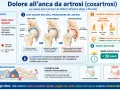 Dolore all'anca da artrosi: peggiora con il carico, migliora con il riposo. La coxartrosi causa dolore inguinale e limita la rotazione interna.