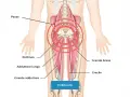 Illustrazione anatomica che mostra i muscoli adduttori e il psoas, evidenziando l'area della pubalgia. Difficoltà nel camminare.