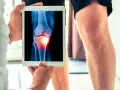 Medico mostra radiografia di un ginocchio con un'area infiammata, evidenziando un problema all'angolo q.