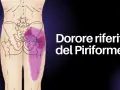 Dolore riferito del piriforme, un sintomo del deep gluteal syndrome, evidenziato in viola sull'anatomia del bacino e della gamba.