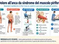 Dolori all'anca: il piriforme infiammato comprime il nervo sciatico, causando dolore profondo al gluteo e irradiazione alla gamba.
