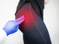 Medico esamina il **dolore all'anca sinistra e al gluteo**, evidenziato da un'area rossa.