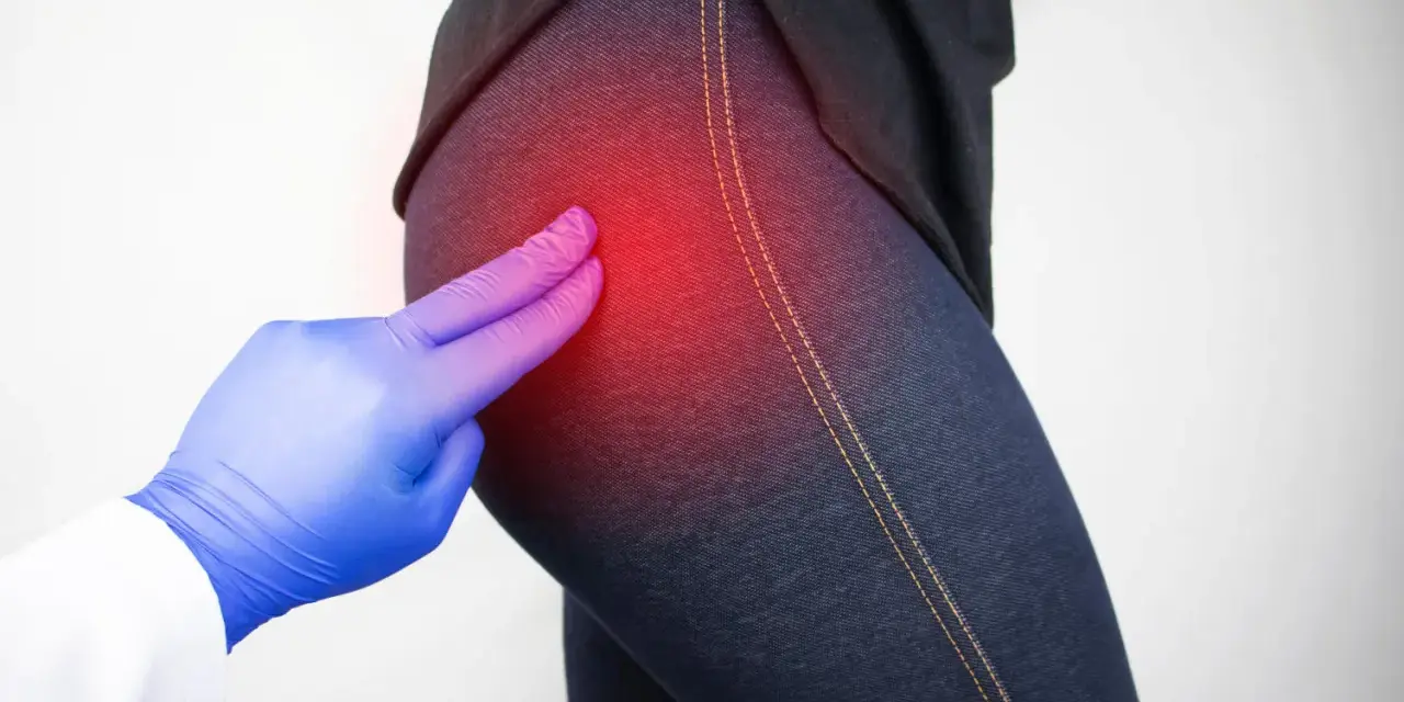 Medico esamina il **dolore all'anca sinistra e al gluteo**, evidenziato da un'area rossa.