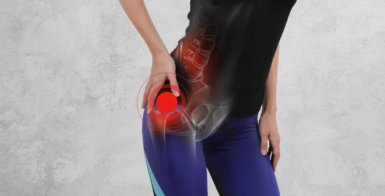 Donna con dolore alle anche e alle gambe, evidenziato da cerchi rossi sull'anca.