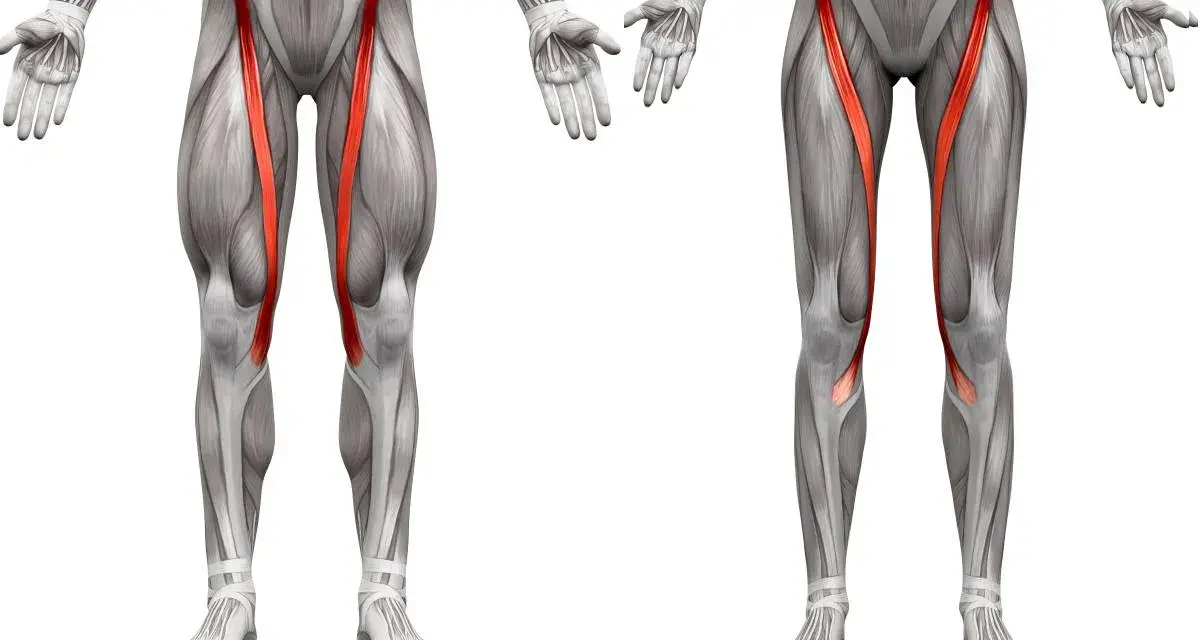 Muscolatura delle gambe con il sartorio infiammato evidenziato in rosso.