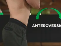 Vista laterale del busto di una persona che mostra un **tilt pelvico anteriore**, evidenziato da frecce verdi.