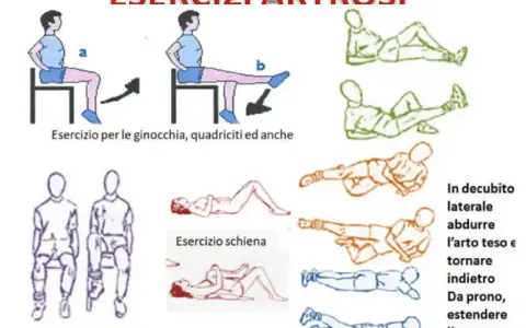 Illustrazioni di esercizi per l'artrosi, inclusi movimenti da seduti e sdraiati. Evitare esercizi che peggiorano l'artrosi dell'anca.