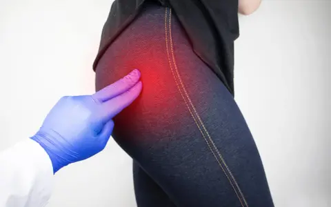 Medico esamina il **dolore all'anca sinistra e al gluteo**, evidenziato da un'area rossa.