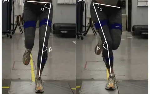 Gambe di una persona durante un hop test, con angoli α e β misurati per analizzare il movimento.