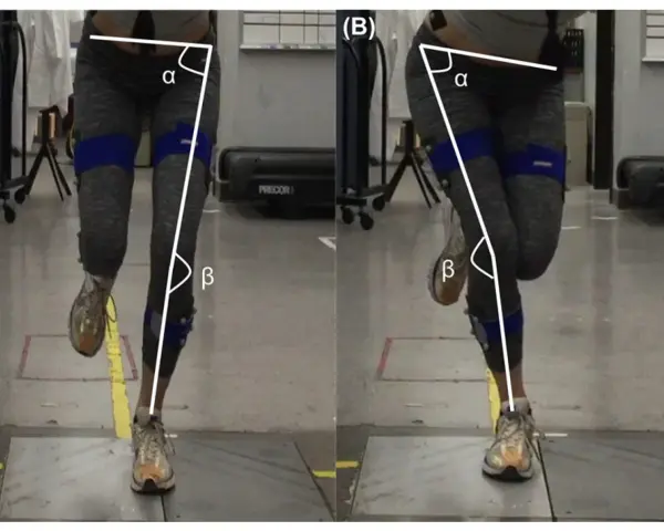 Gambe di una persona durante un hop test, con angoli α e β misurati per analizzare il movimento.