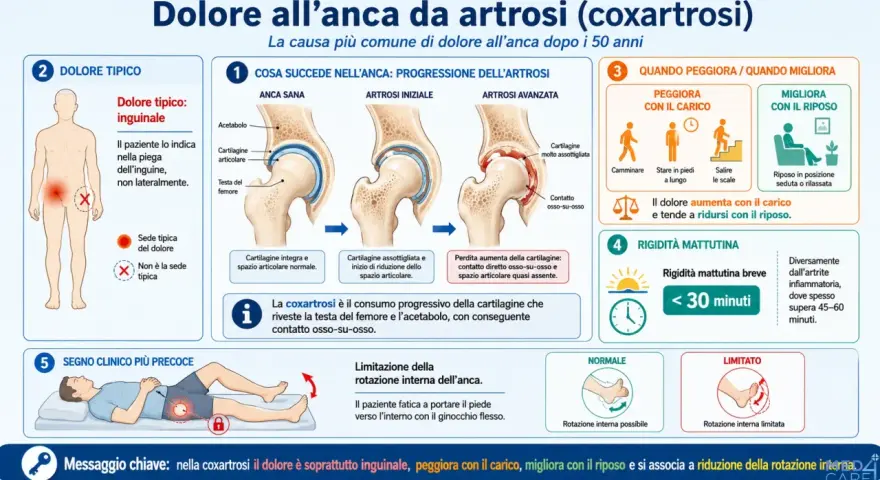 Dolore all'anca da artrosi: peggiora con il carico, migliora con il riposo. La coxartrosi causa dolore inguinale e limita la rotazione interna.