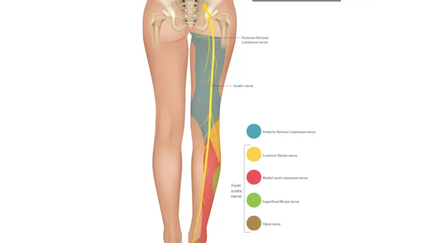 Illustrazione anatomica che mostra l'innervazione sensoriale del nervo sciatico, utile per capire il dolore da nervo sciatico infiammato.