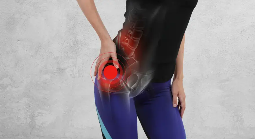 Donna con dolore alle anche e alle gambe, evidenziato da cerchi rossi sull'anca.