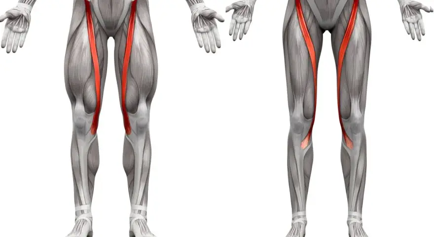 Muscolatura delle gambe con il sartorio infiammato evidenziato in rosso.