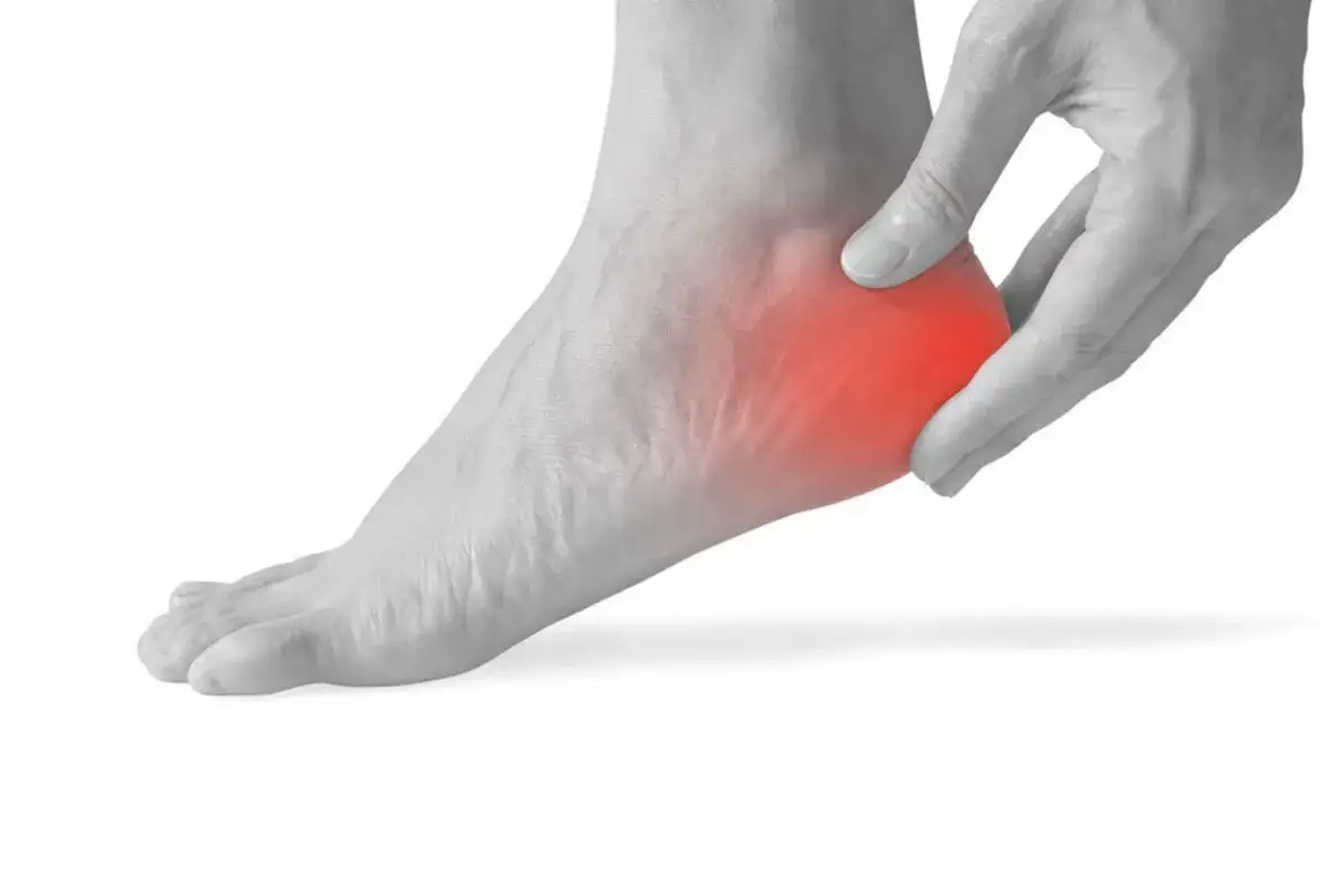 Mano che preme sul tallone, evidenziato in rosso, per indicare il dolore al tallone.
