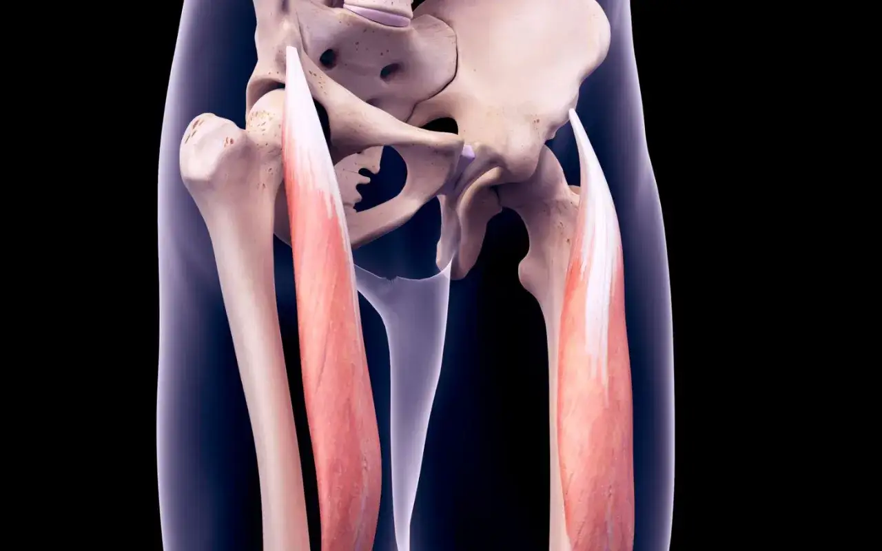 Muscoli dell'interno coscia, con evidenza di un potenziale strappo interno coscia.