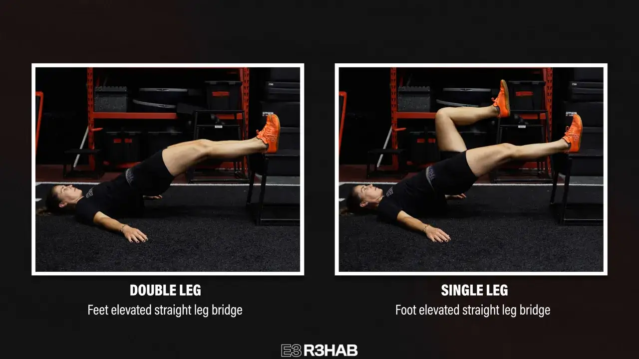 Esercizi per i hamstring: ponte gambe sollevate (doppia e singola gamba) per rafforzare i muscoli posteriori della coscia.